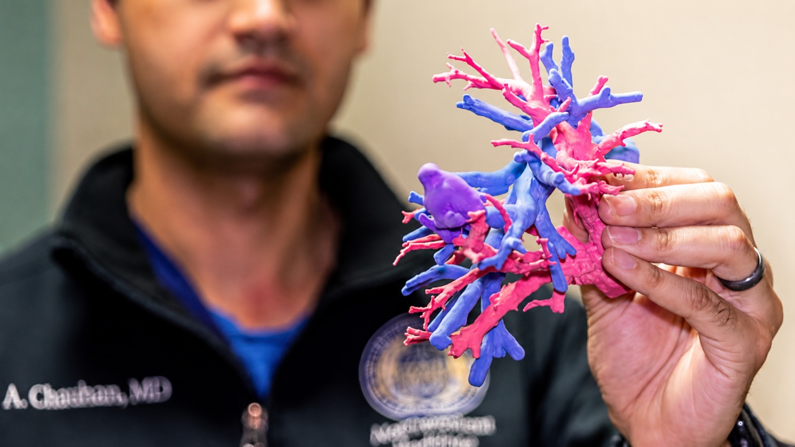 A physician holding a full-color 3D-printed model of a patient's branching blood vessels
